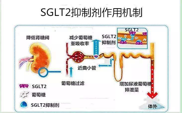 SGLT-2抑制剂降糖机制.jpg